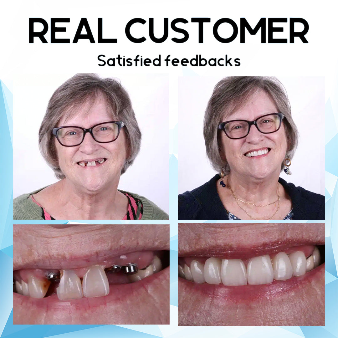 Recommended by the British Dental Association 𝐒𝐢𝐥𝐢𝐜𝐨𝐧𝐞 𝐑𝐞𝐥𝐢𝐧𝐞 𝐃𝐞𝐧𝐭𝐮𝐫𝐞 𝐒𝐞𝐭 (⏰𝐋𝐢𝐦𝐢𝐭𝐞𝐝 𝐭𝐢𝐦𝐞 𝐝𝐢𝐬𝐜𝐨𝐮𝐧𝐭 𝐋𝐚𝐬𝐭 𝟑𝟎 𝐦𝐢𝐧𝐮𝐭𝐞𝐬⏰)😁